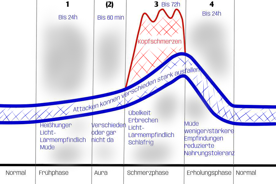 Verlauf einer Migräneattacke schematisch dargestellt mit Frühphase, Auraphase, Schmerzphase und Erholungsphase und den Symptomen kurz zusammengefasst, die in den jeweiligen Phasen am stärksten vorherrschen.